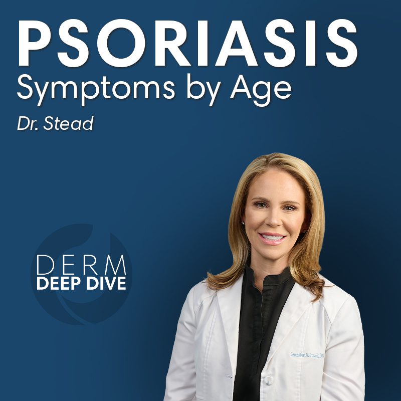 Psoriasis Symptoms by Age
