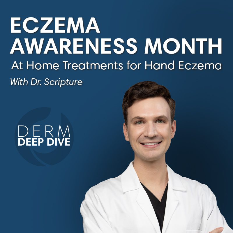 Hand Eczema Treatments