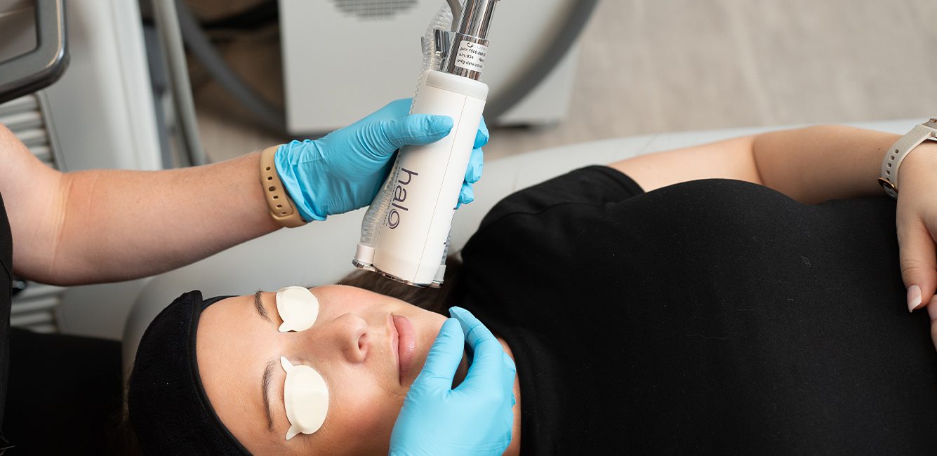 Best Time for Laser Treatments