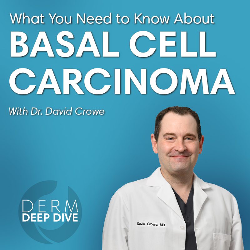 Derm Deep Dive: What is Basal Cell Carcinoma?